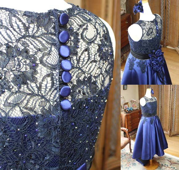 背後の細工 クルミボタン